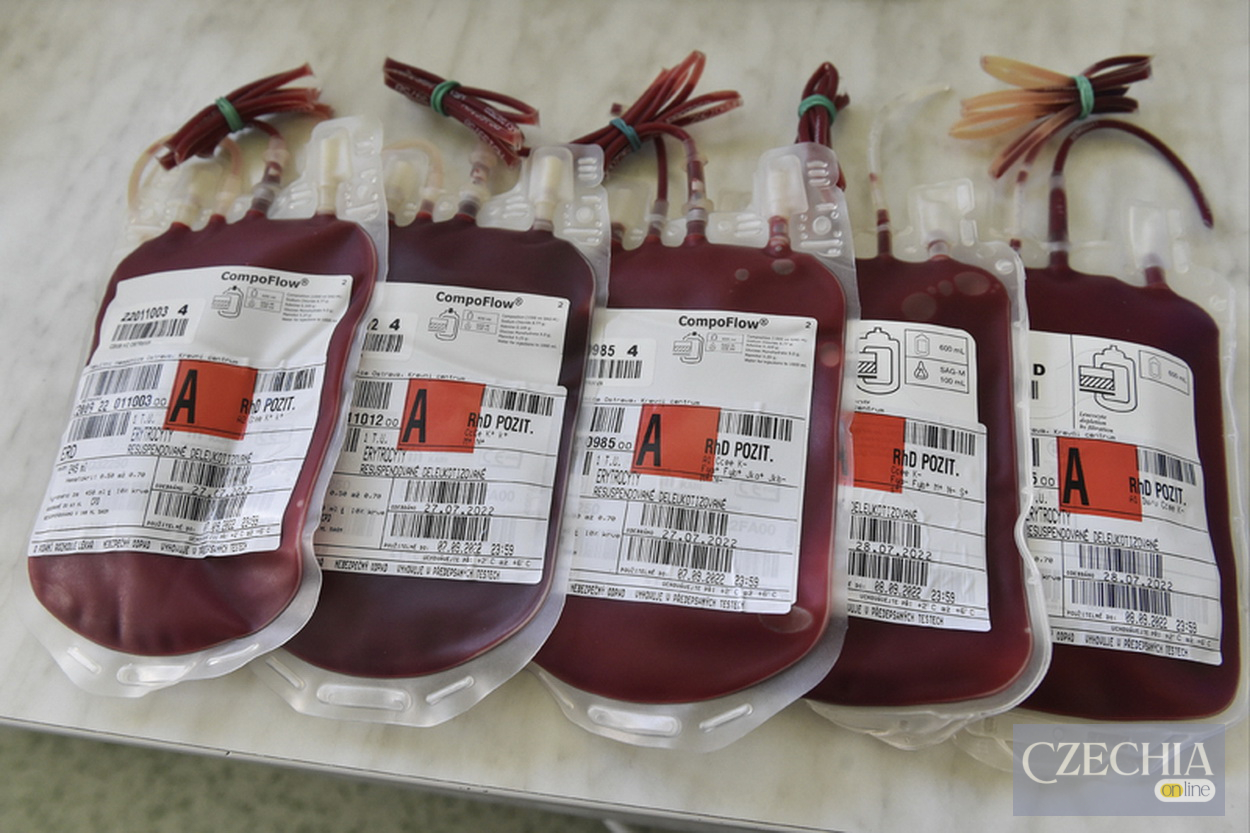 У Чехії фіксують дефіцит крові від донорів груп А та О, яким пропонують податкову знижку у 3000 крон