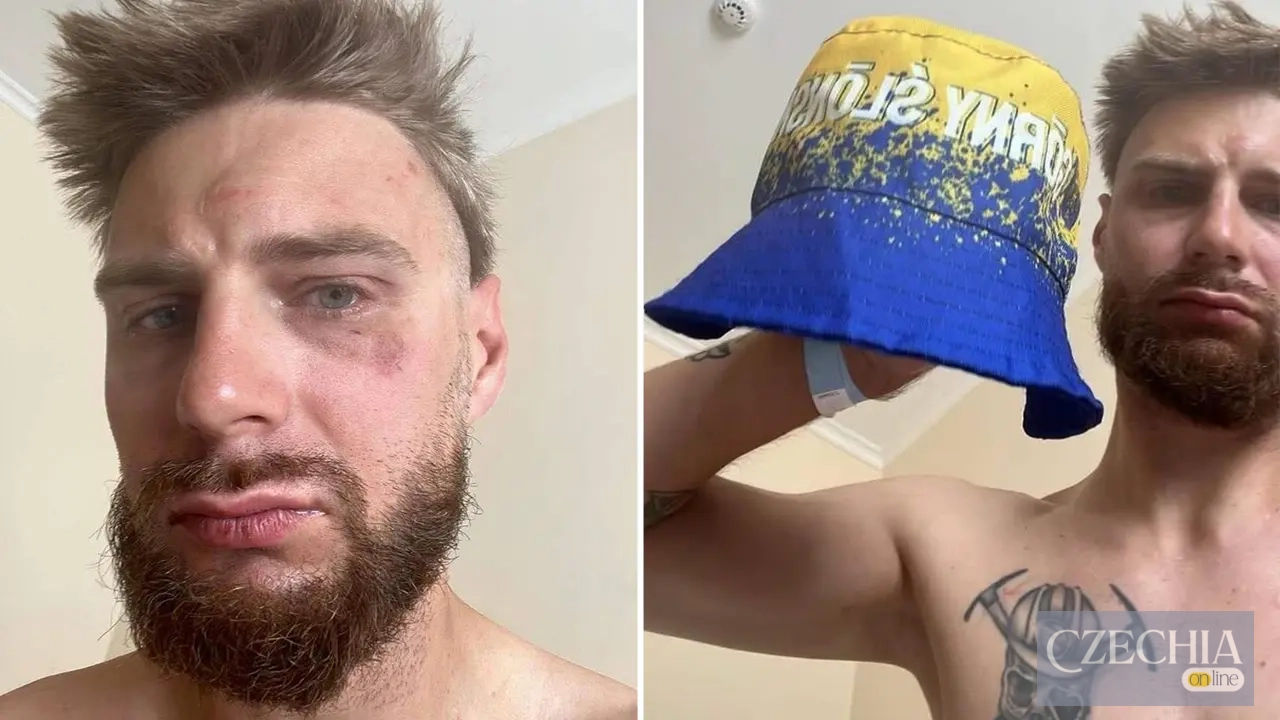 В Остраві побили поляка Якуба Гайсіга В Остраві побили поляка Якуба Гайсіга